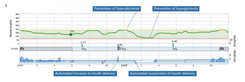 graph showing the effects of insulin on the pancreas - more info in the article